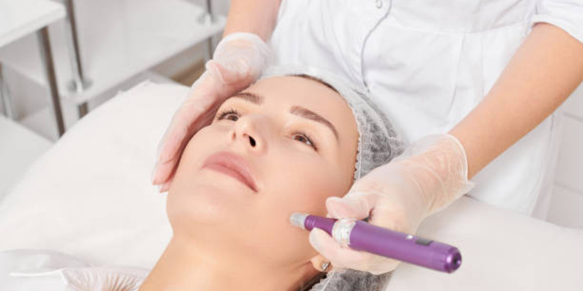 Benefits of SkinPen Microneedling for Flawless Skin in 2024