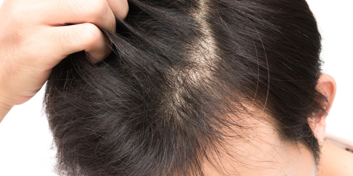 Stem Cell Hair Treatment Near Me: Your Path to Hair Regrowth